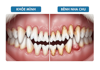 đánh răng cho chó